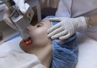 عملية التجديد