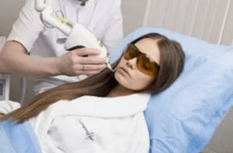 تجديد الليزر الجزئي